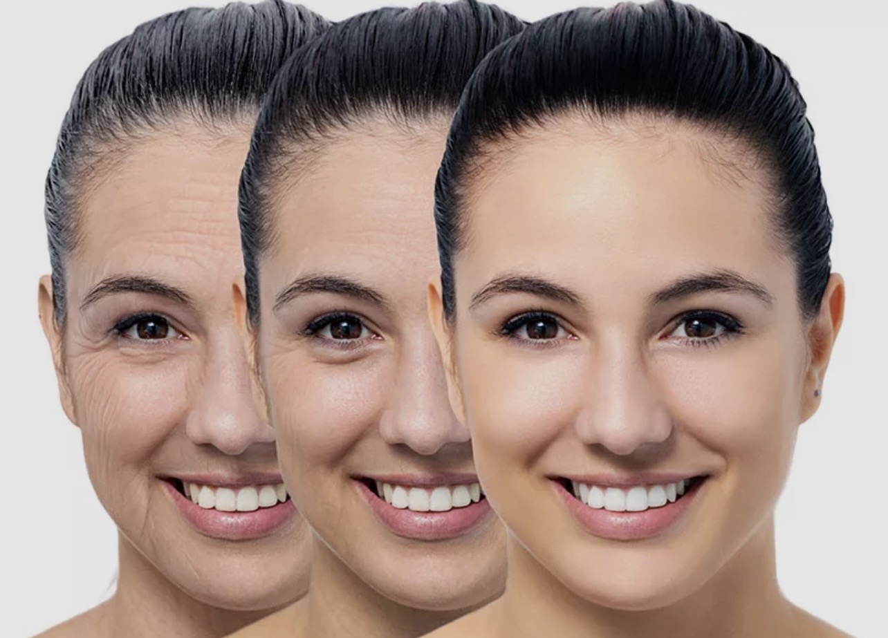Rejuvenescimento Facial — imagem 1